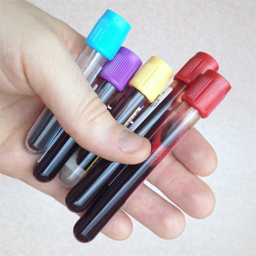 Tubos de muestra para exámenes de laboratorio