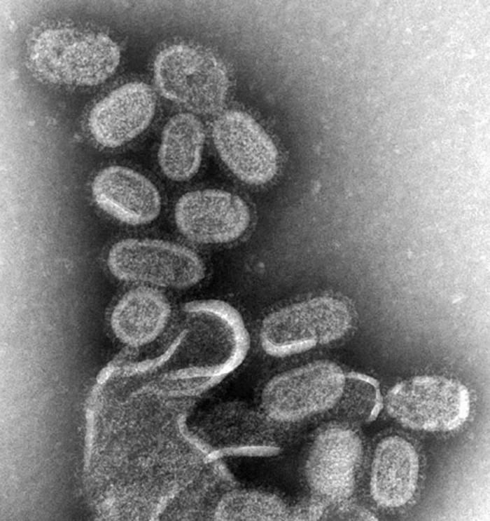 Virus de la influenza visto al microscopio